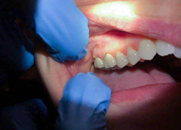 Best Emergency Treatment for Jaw Pain or Injury in Haliimaile, HI